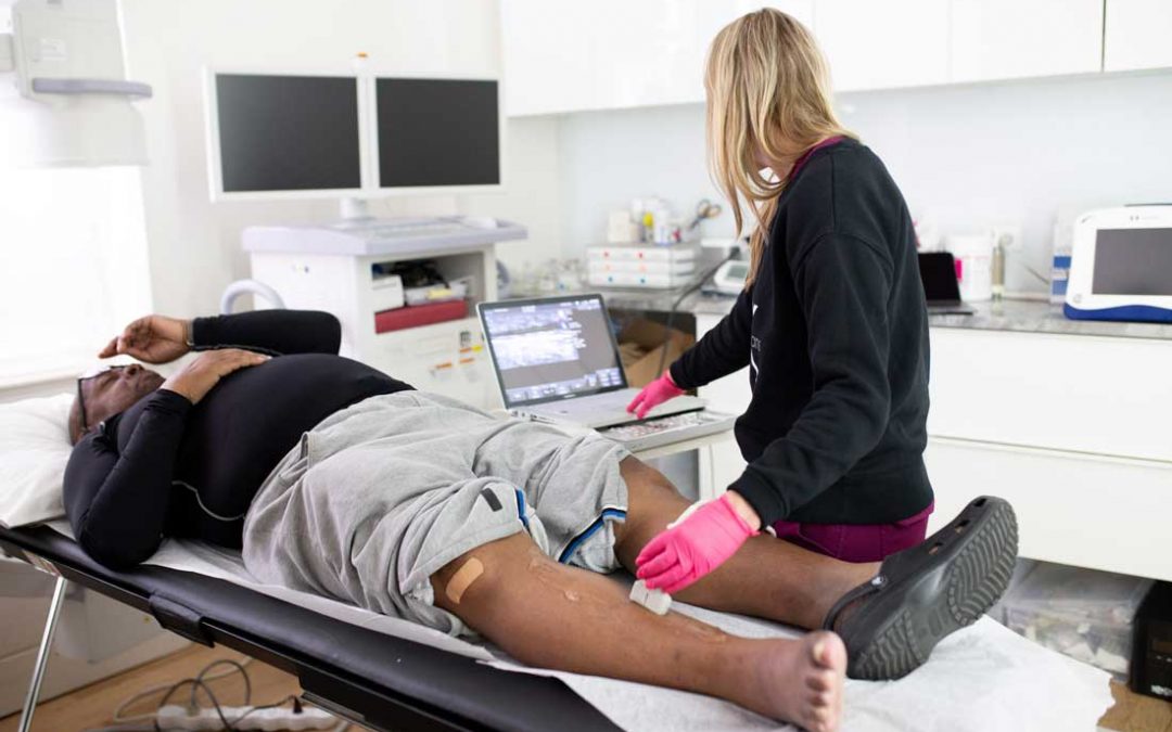 Top Signs I Need to Consult a Varicose Vein Treatment Center Near Me in Houston | How Can I Find a Vein Doctor?