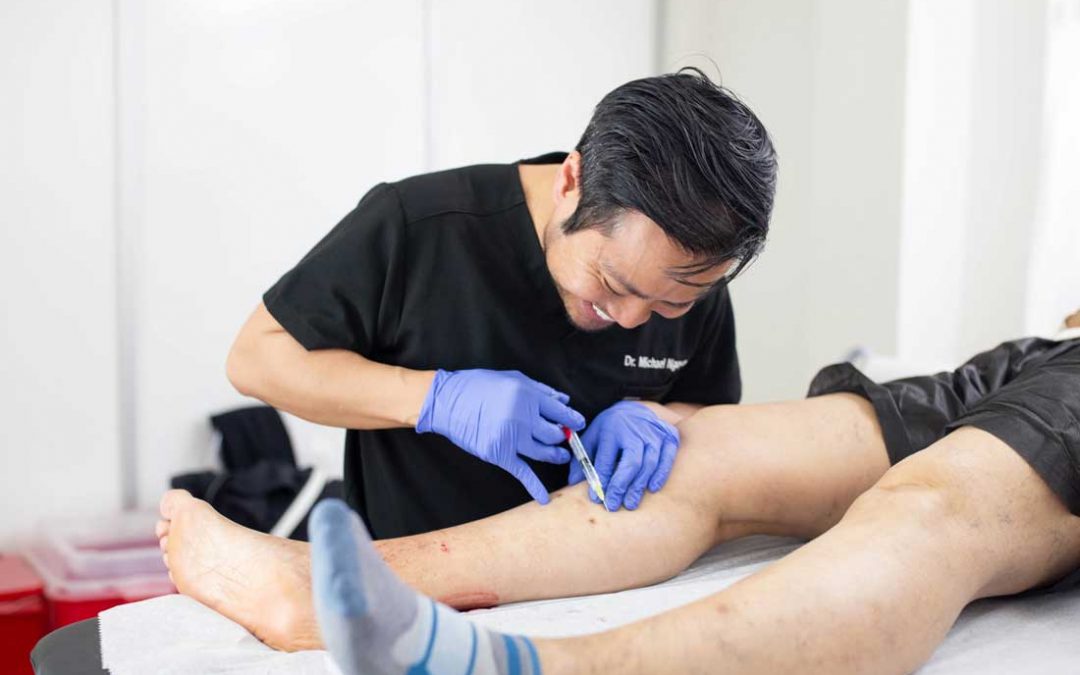 How Can I Find a Vein Clinic Near Me in River Oaks?